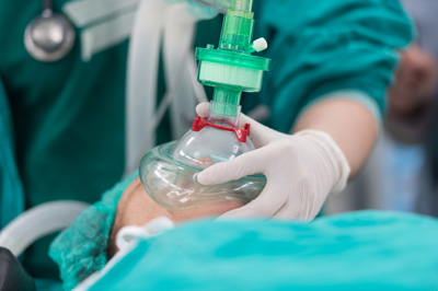 Gali būti sukeliama per kvėpavimo kaukę, panašią į deguonies, arba anestetikas leidžiamas į kraują specialiai įvestu intraveniniu kateteriu.