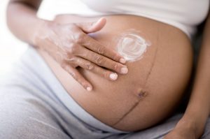 Pigmentinės dėmės nėštumo metu